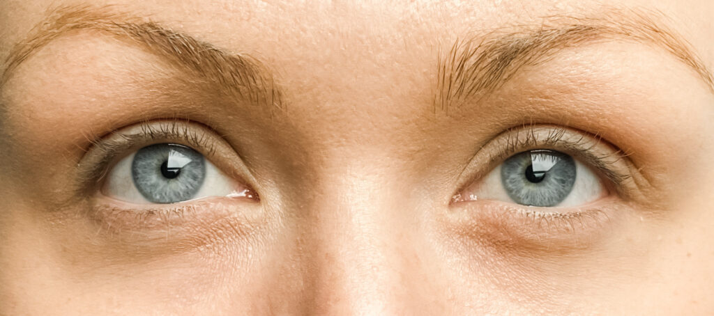 Silly George Eyelash Serum Before And After